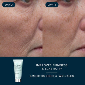 ELEMIS resurfacing pad applied to cheek showing exfoliation for smoother texture
