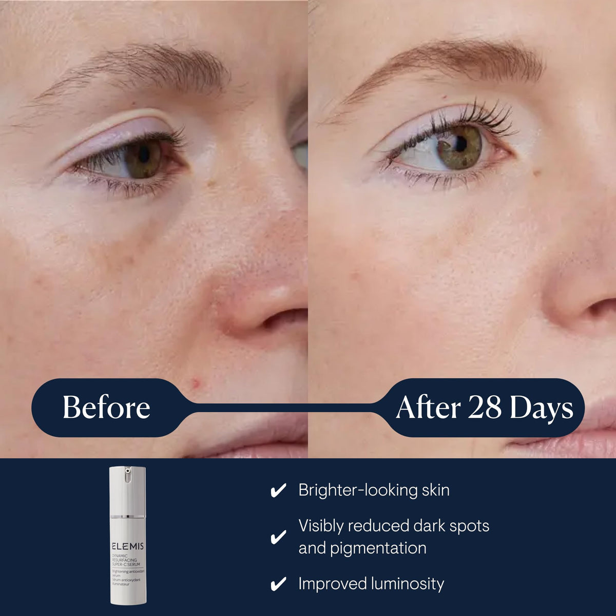 ELEMIS Super-C pump dispensing serum, illustrating easy application and controlled dosing benefit