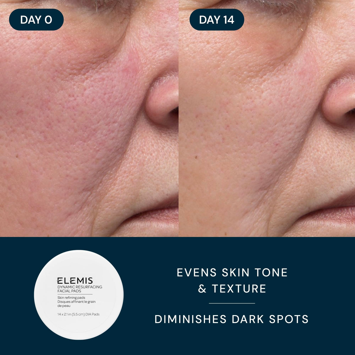 ELEMIS cleansing balm texture on skin demonstrating melting makeup removal