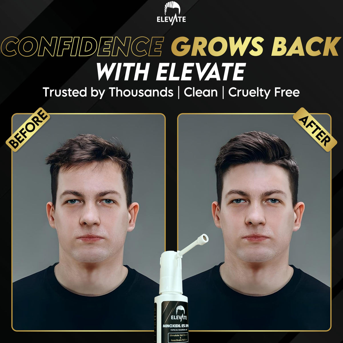 Elevate illustrated before and after hair density comparison