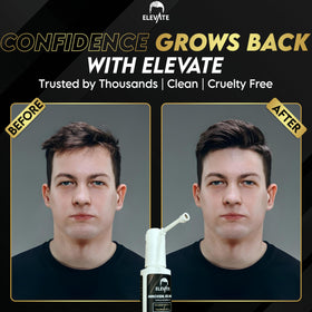Elevate illustrated before and after hair density comparison