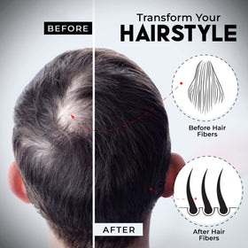 Elevate before and after crown showing fuller-looking top and instant visual improvement