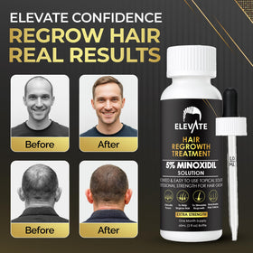 Elevate bottle label detail showing ingredients and strength, reassures quality