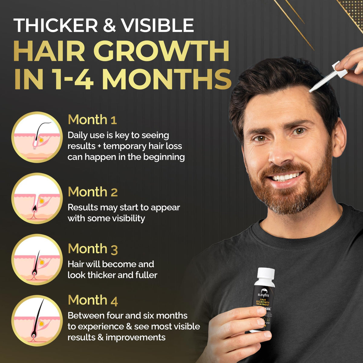 Elevate scalp application demo targeting crown area, supports thicker hair