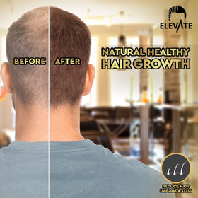 Elevate scalp application demonstrating targeted use and improved manageability