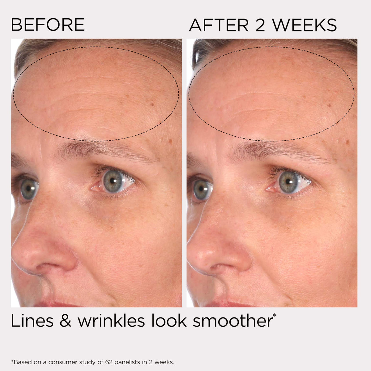 Elizabeth Arden PREVAGE ingredient graphic highlighting Idebenone antioxidant protection