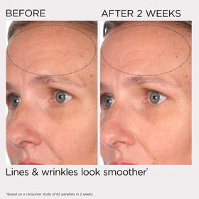 Elizabeth Arden PREVAGE ingredient graphic highlighting Idebenone antioxidant protection