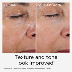 Elizabeth Arden PREVAGE ingredients label closeup displaying idebenone and key actives for informed choice
