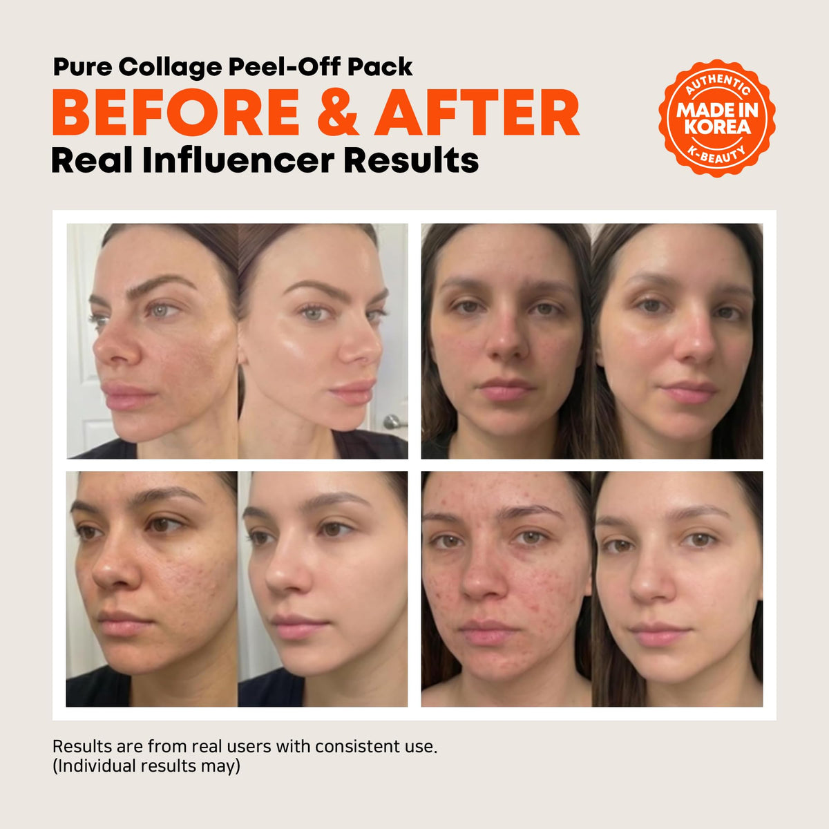 ELT peel-off removal process showing clean lifting benefit