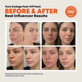 ELT peel-off removal process showing clean lifting benefit
