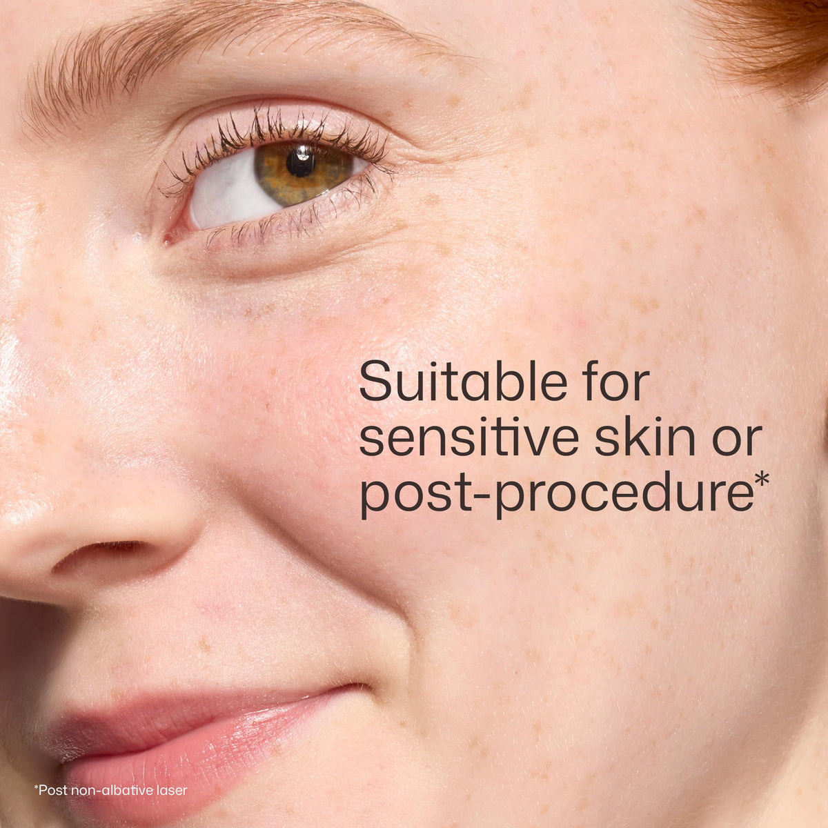 Cheek before and after EltaMD application showing reduced redness effect