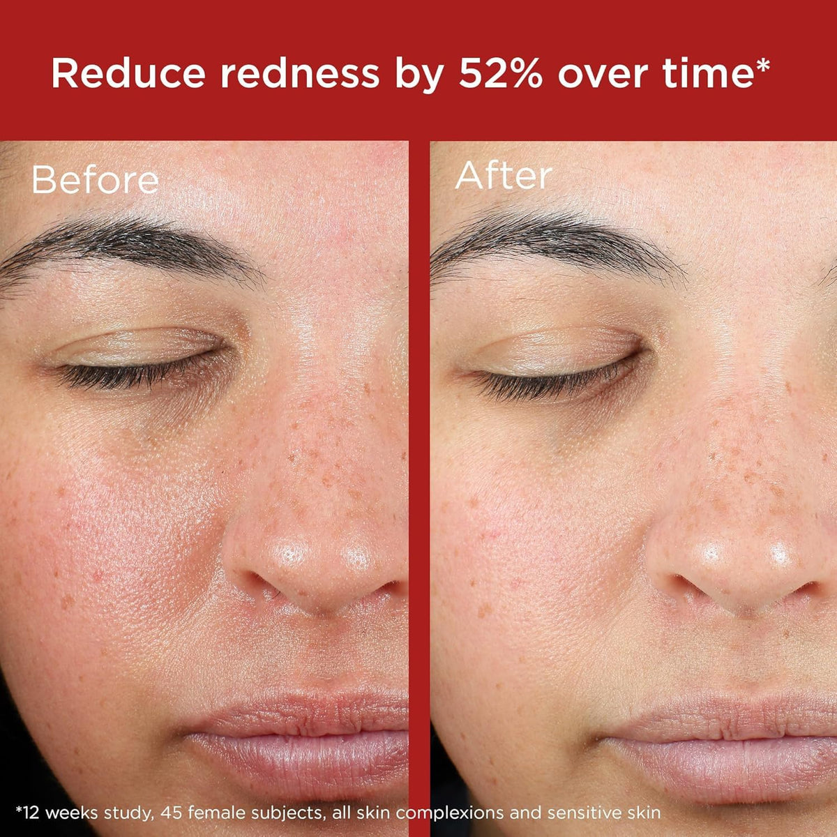 EltaMD lotion blending on cheek demonstrating seamless coverage benefit