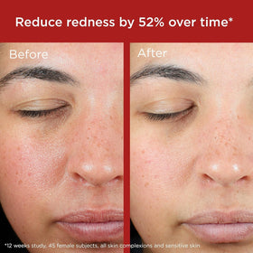 EltaMD lotion blending on cheek demonstrating seamless coverage benefit