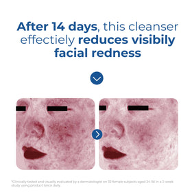 EltaMD in travel bag demonstrating portability for skincare on-the-go