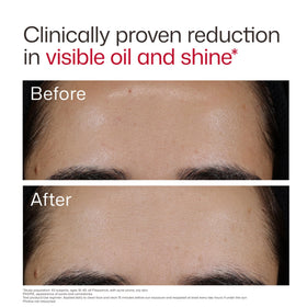 EltaMD ingredient focus on niacinamide emphasizing oil-control support