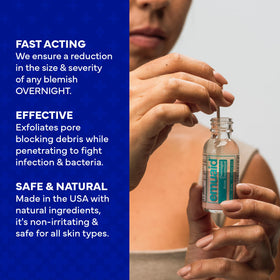 emuaid applying a small dab to a pimple before sleep for overnight reduction