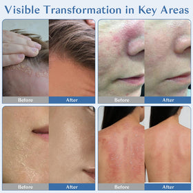 Eoiroa cream applied to face from hand for quick absorption benefit