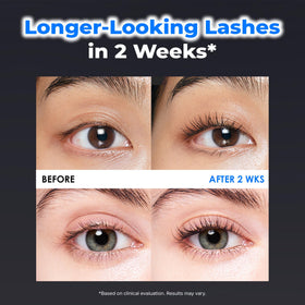 EPAIS ball-tip applicator on lashline for targeted root conditioning and control