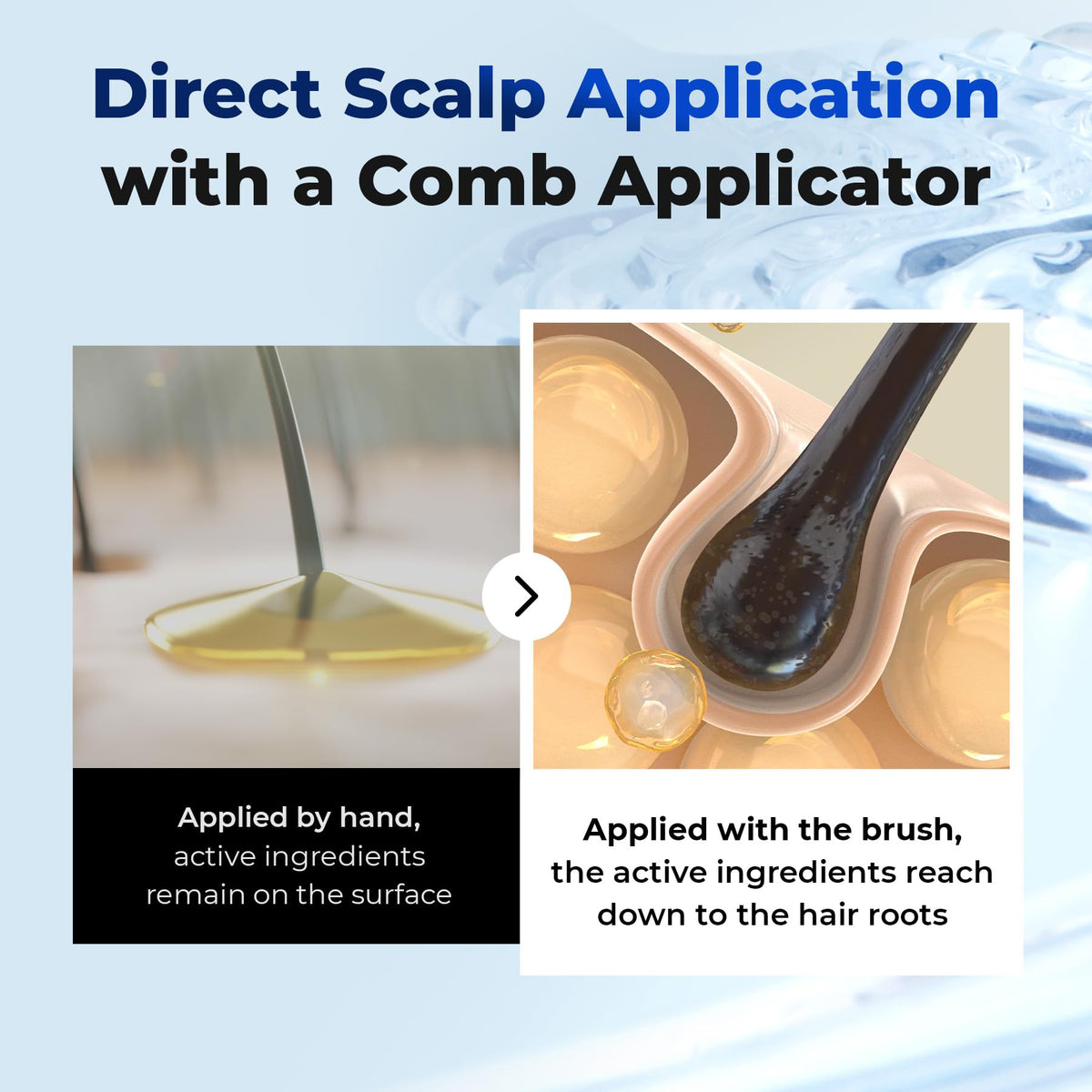 EPAIS applicator in use on scalp showing hygienic targeted application