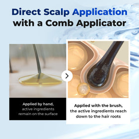 EPAIS applicator in use on scalp showing hygienic targeted application