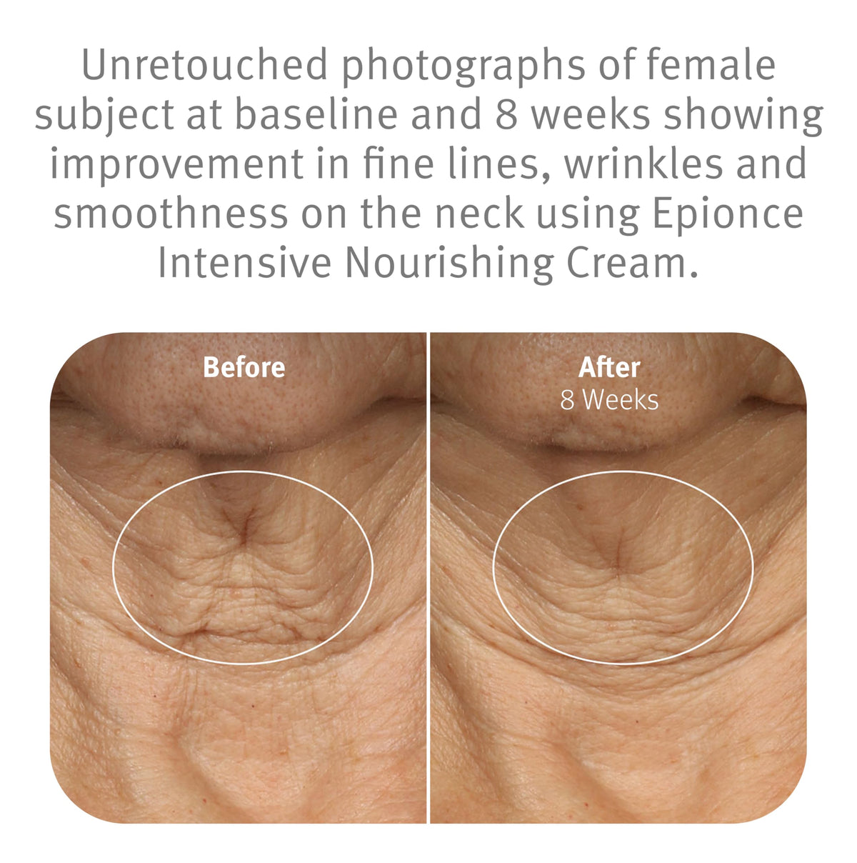 Epionce cream being scooped with fingers for easy daily application