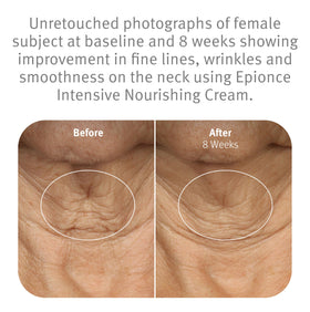 Epionce cream being scooped with fingers for easy daily application