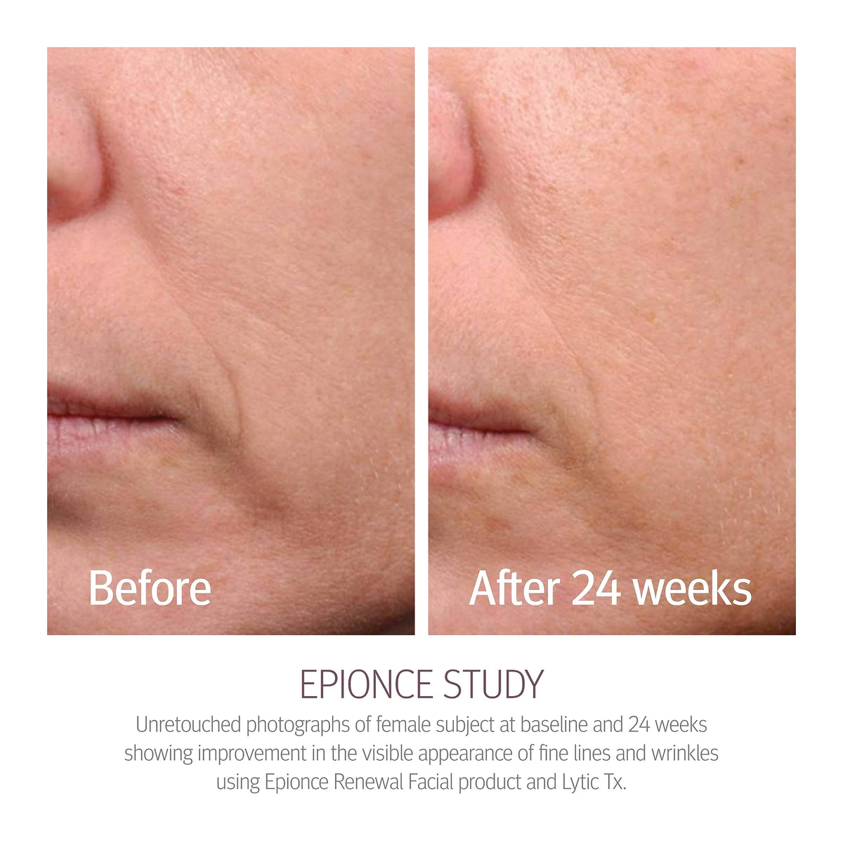 Epionce close-up texture showing lightweight lotion for fast absorption