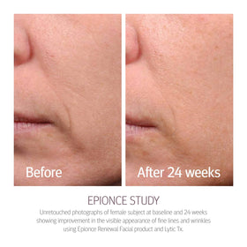 Epionce close-up texture showing lightweight lotion for fast absorption