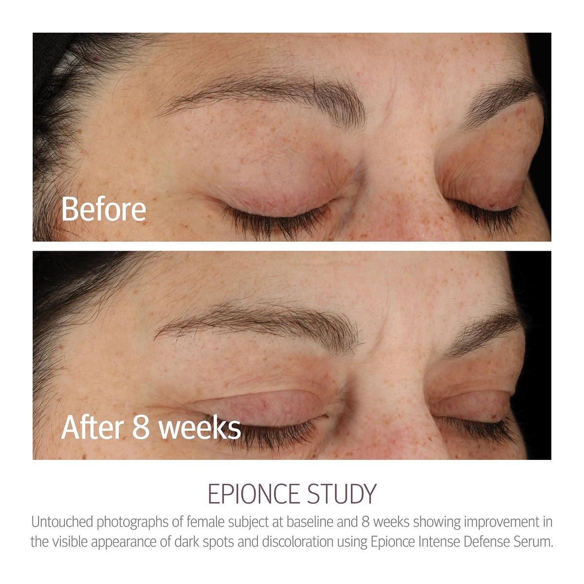 Epionce pipette dispensing serum, demonstrates precise application control