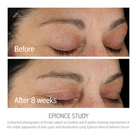 Epionce pipette dispensing serum, demonstrates precise application control