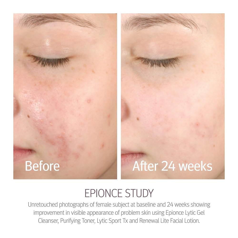 Epionce lotion texture on hand illustrating lightweight hydration