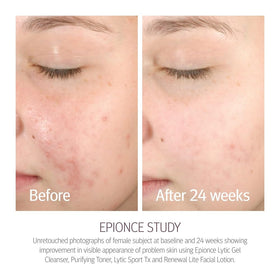 Epionce lotion texture on hand illustrating lightweight hydration