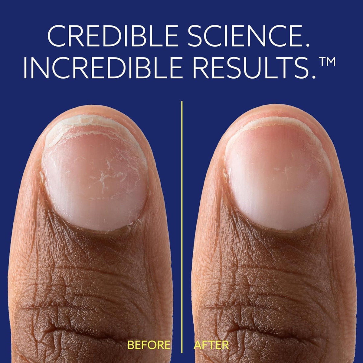 epres ePhD close-up of product absorbing into nail demonstrating internal repair