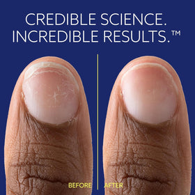 epres ePhD close-up of product absorbing into nail demonstrating internal repair