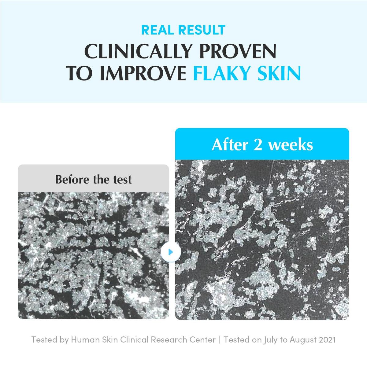 EQQUALBERRY toner on cotton pad showing gentle exfoliation and convenience