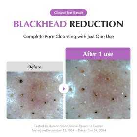 EQQUALBERRY purple rice grains ingredient focus highlighting antioxidant boost