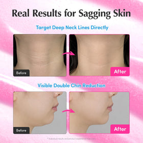 EQQUALBERRY applied to neck demonstrating firming and smoothing effect