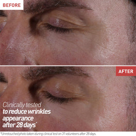 Erborian before and after eye area showing reduced puffiness appearance