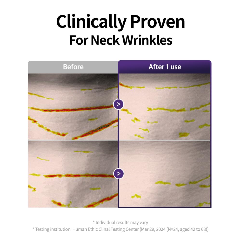 ESSL LIGHT patches on décolletage lifestyle image enhancing confidence