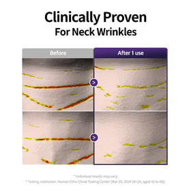 ESSL LIGHT patches on décolletage lifestyle image enhancing confidence