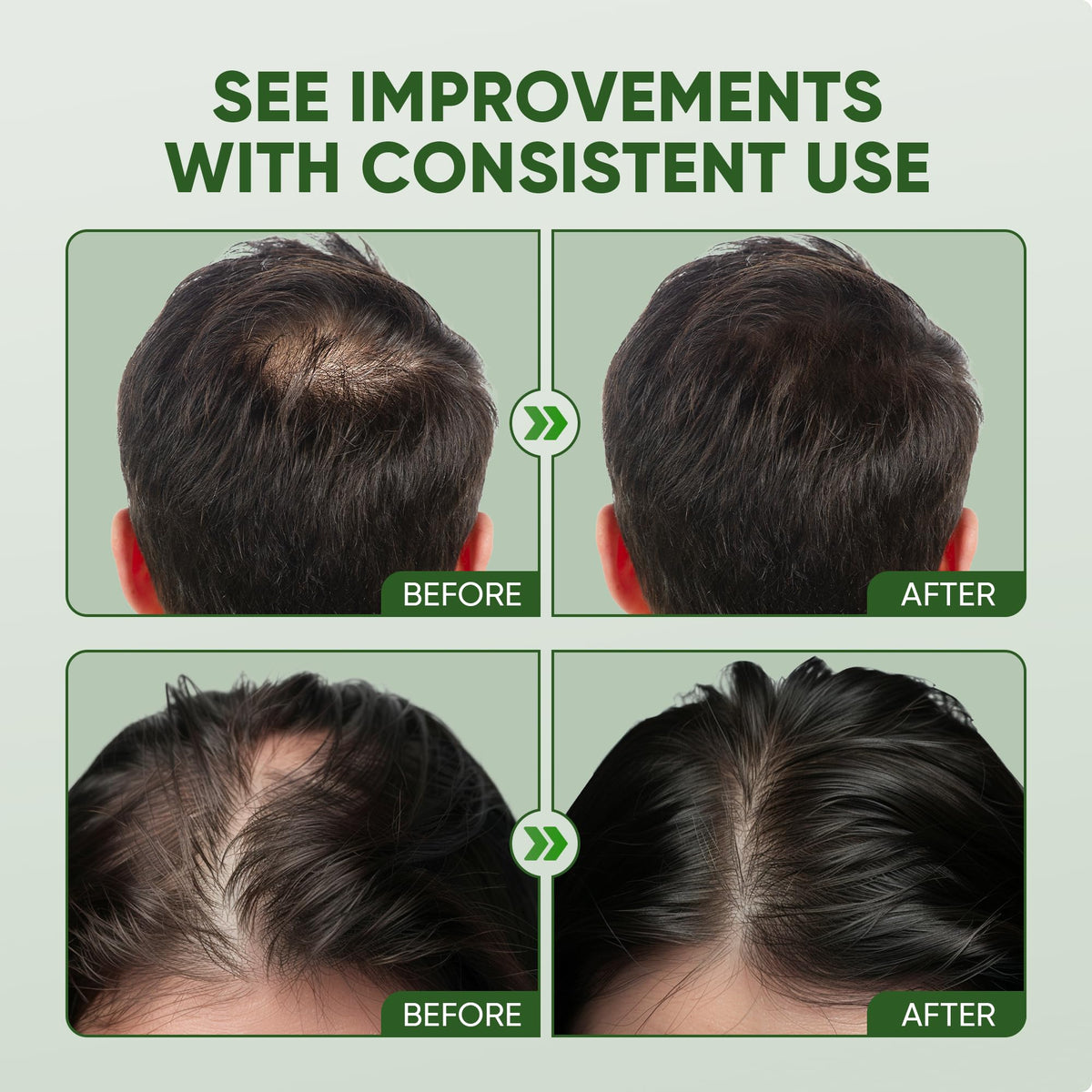 Essynaturals Advanced hair before and after comparison illustrating fuller appearance