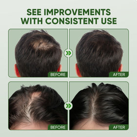 Essynaturals Advanced hair before and after comparison illustrating fuller appearance