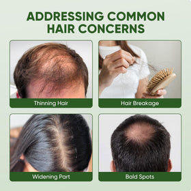 Essynaturals Advanced applied to scalp by hand promoting targeted nourishment
