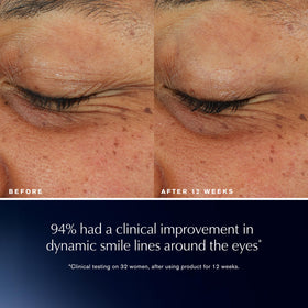 Estée Lauder applying cream under eye for immediate smoothing and comfort