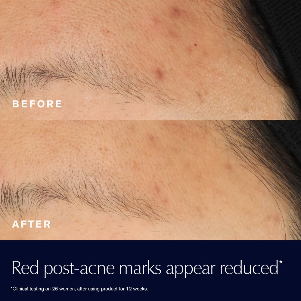 Estée Lauder Rescue Solution pipette dispensing serum for precise application and minimal waste