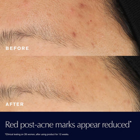 Estée Lauder Rescue Solution pipette dispensing serum for precise application and minimal waste
