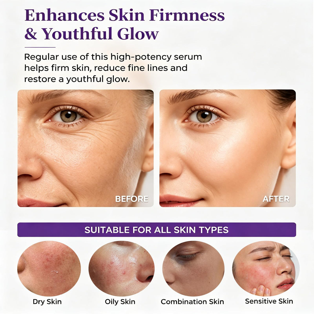 eteross illustrative before-and-after visual suggesting improved skin texture