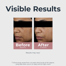 Eucerin Thiamidol ingredient close-up highlighting targeted dark spot benefit