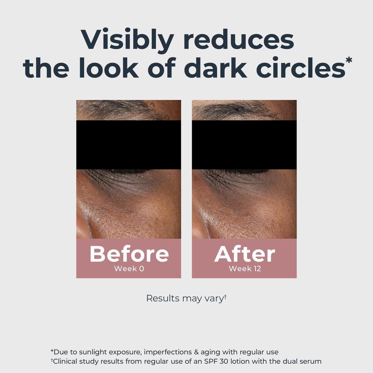 Eucerin under-eye application demo illustrating gentle massage and immediate brightening