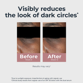 Eucerin under-eye application demo illustrating gentle massage and immediate brightening